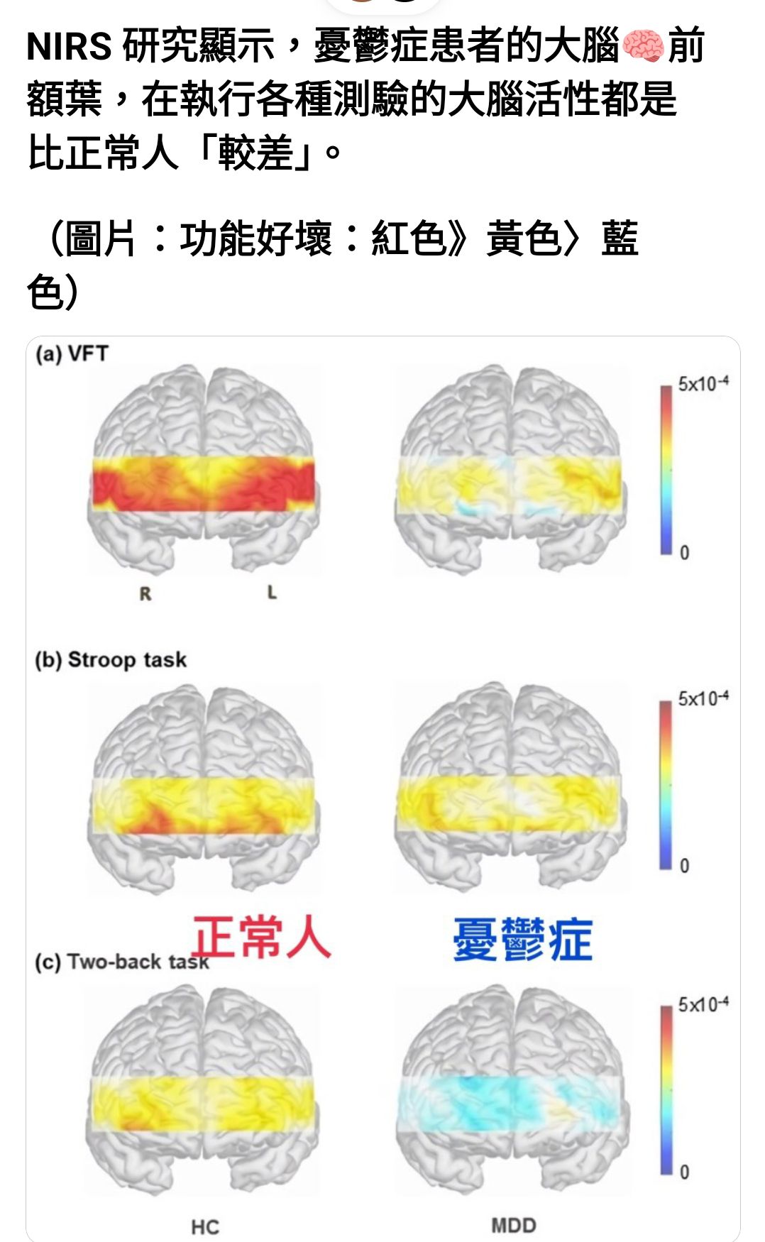 2605 新興- 聊聊憂鬱症~｜CMoney 股市爆料同學會