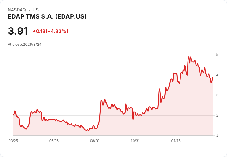 EDAP TMS第四季財報喜憂參半,2026年展望再度確認!